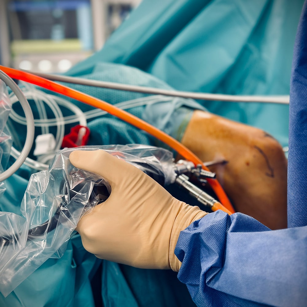 arthroscopie du coude pathologie du coude dr pierre laumonerie chirurgien specialiste du coude paris