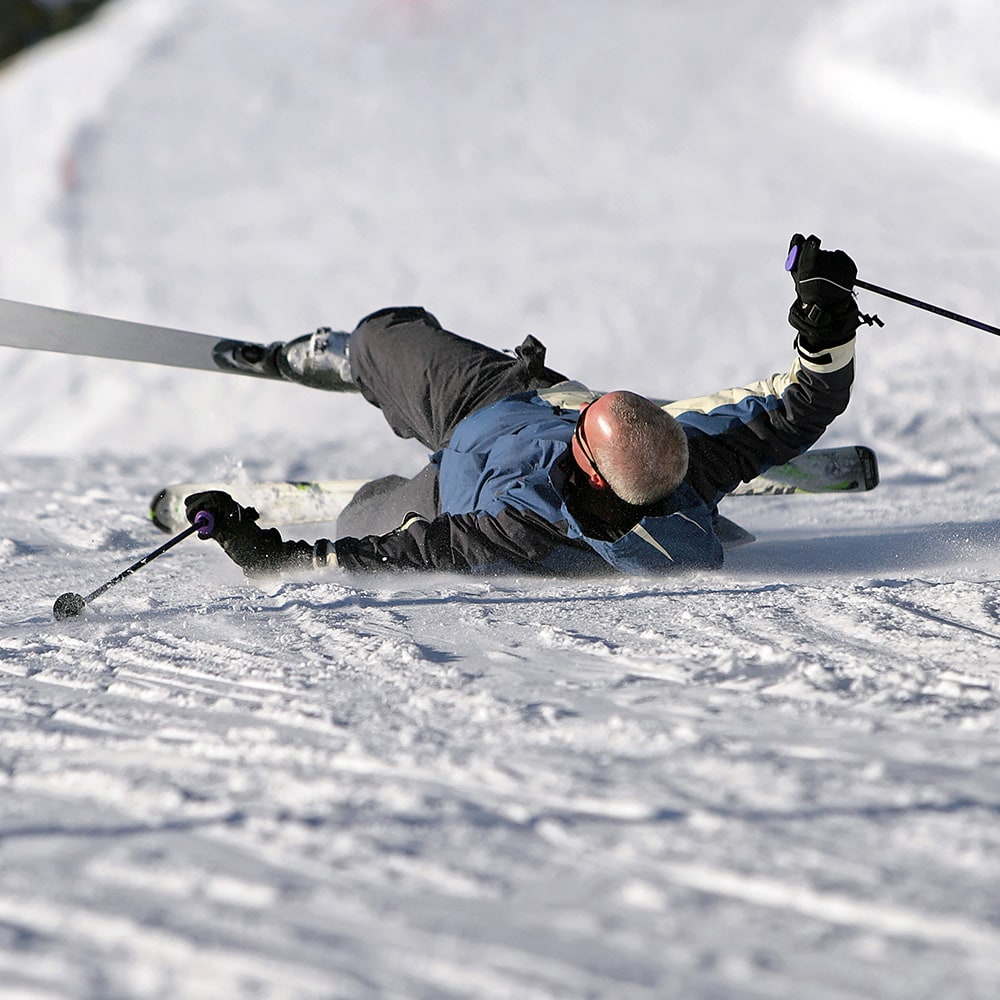 fracture de la tete radiale temps de consolidation pathologie du coude dr pierre laumonerie chirurgien specialiste du coude paris